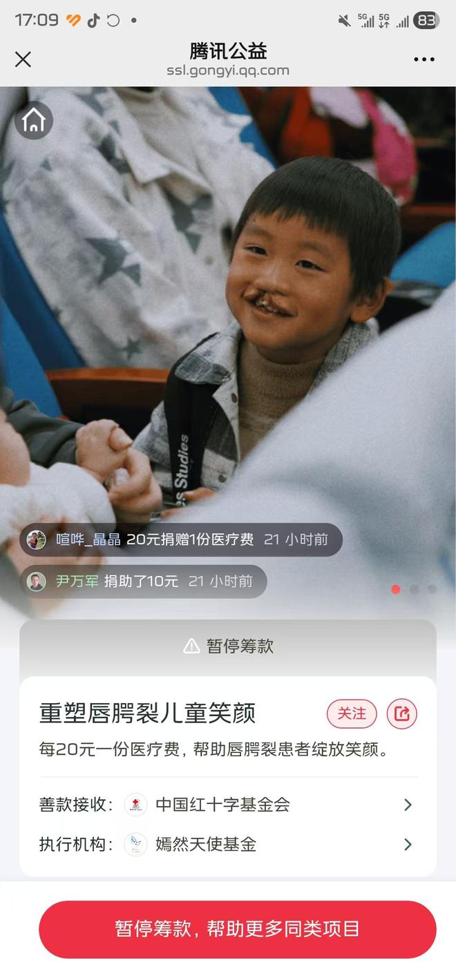 嫣然天使基金停止捐款？其他渠道还可以(1)